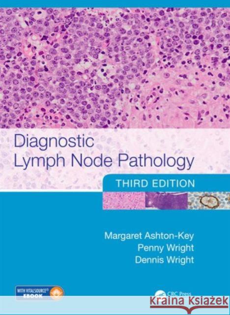 Diagnostic Lymph Node Pathology