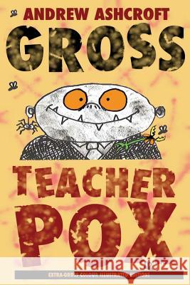 Gross Teacherpox