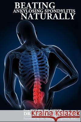 Beating Ankylosing Spondylitis Naturally