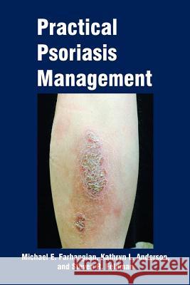 Practical Psoriasis Management