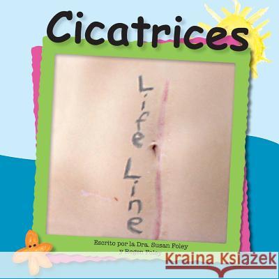 Cicatrices