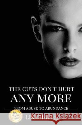 The Cuts Don't Hurt Anymore: From Abuse To Abundance