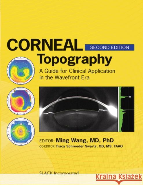 Corneal Topography: A Guide for Clinical Application in the Wavefront Era