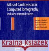 Atlas of Cardiovascular Computed Tomography: includes narrated videos