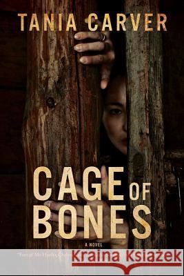 Cage of Bones