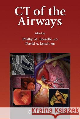 CT of the Airways