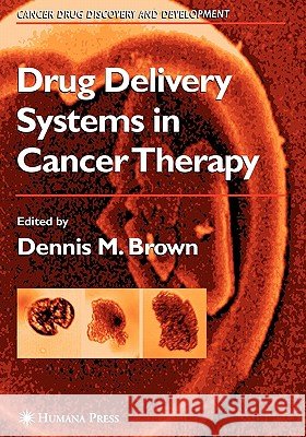 Drug Delivery Systems in Cancer Therapy