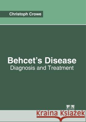 Behcet's Disease: Diagnosis and Treatment