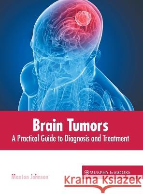 Brain Tumors: A Practical Guide to Diagnosis and Treatment