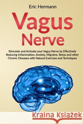 Vagus Nerve: Stimulate and Activate your Vagus Nerve by Effectively Reducing Inflammation, Anxiety, Migraine, Stress and other Chro