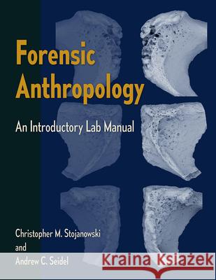 Forensic Anthropology: An Introductory Lab Manual