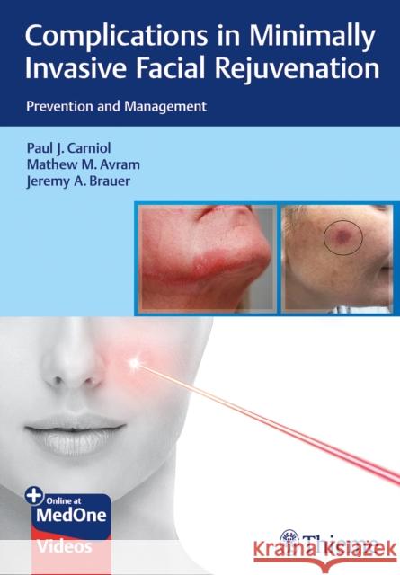 Complications in Minimally Invasive Facial Rejuvenation: Prevention and Management