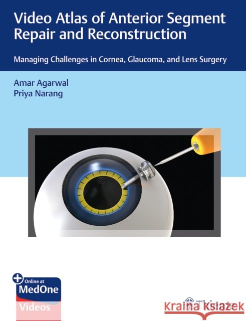 Video Atlas of Anterior Segment Repair and Reconstruction: Managing Challenges in Cornea, Glaucoma, and Lens Surgery