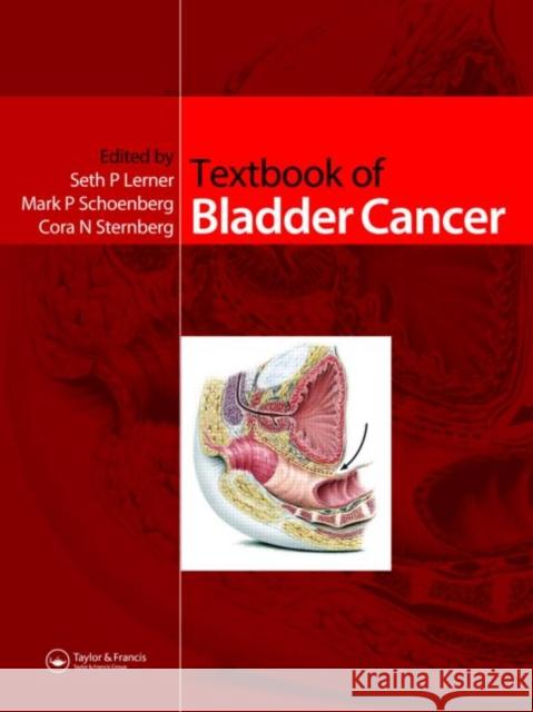 Textbook of Bladder Cancer