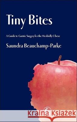 Tiny Bites : A Guide to Gastric Surgery for the Morbidly Obese