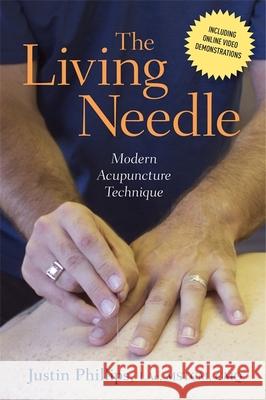 The Living Needle: Modern Acupuncture Technique