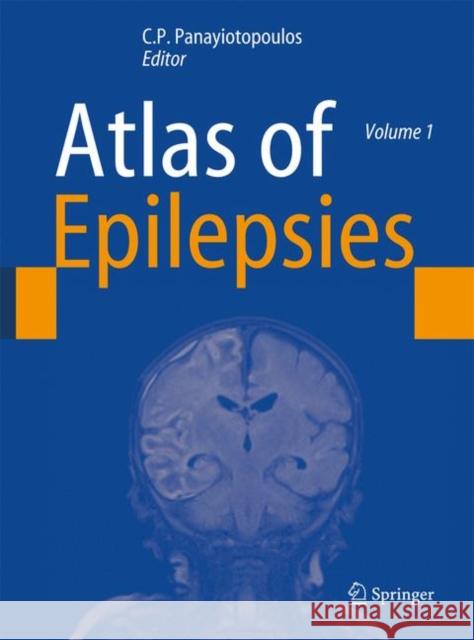 Atlas of Epilepsies