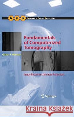 Fundamentals of Computerized Tomography: Image Reconstruction from Projections