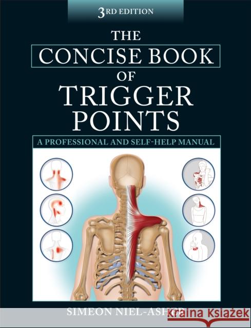 The Concise Book of Trigger Points