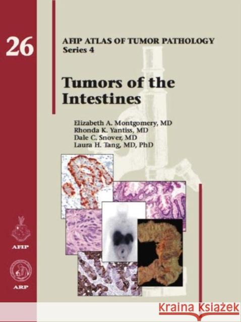 Tumors of the Intestines 