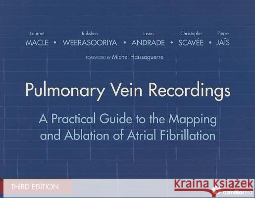 Pulmonary Vein Recordings: A Practical Guide to the Mapping and Ablation of Atrial Fibrillation