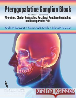 Pterygopalatine Ganglion Block: For Effective Treatment of Migraine, Cluster Headache, Postdural Puncture Headache & Postoperative Pain