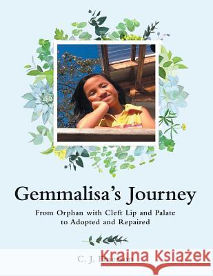 Gemmalisa's Journey: From Orphan with Cleft Lip and Palate to Adopted and Repaired