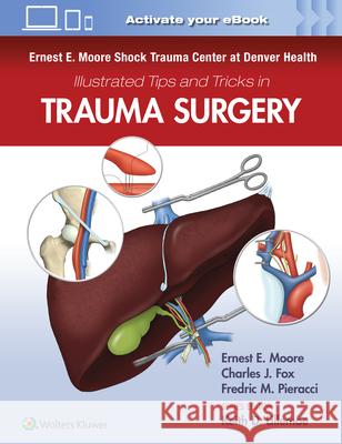 Ernest E. Moore Shock Trauma Center at Denver Health Illustrated Tips and Tricks in Trauma Surgery