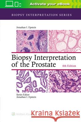 Biopsy Interpretation of the Prostate