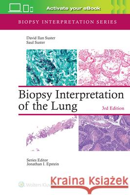 Biopsy Interpretation of the Lung