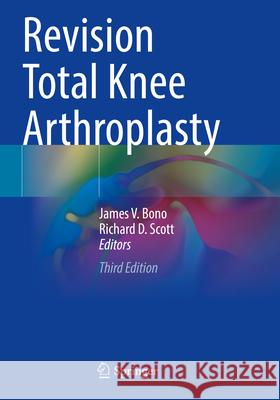 Revision Total Knee Arthroplasty
