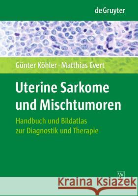 Uterine Sarkome und Mischtumoren: Handbuch und Bildatlas zur Diagnostik und Therapie
