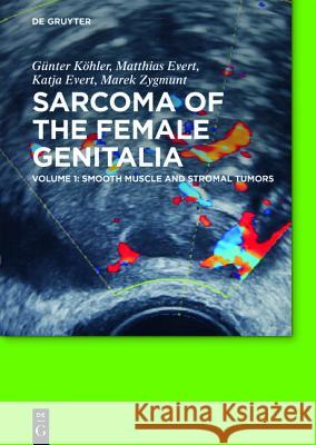 Smooth muscle and stromal tumors and prevention of inadequate surgery