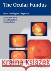 The Ocular Fundus: From Findings to Diagnosis