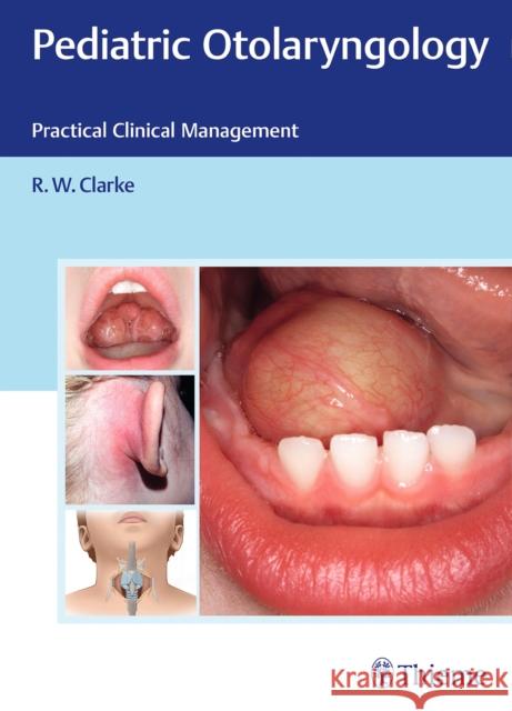 Pediatric Otolaryngology: Practical Clinical Management