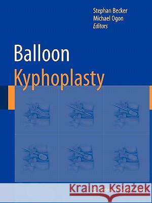 Balloon Kyphoplasty