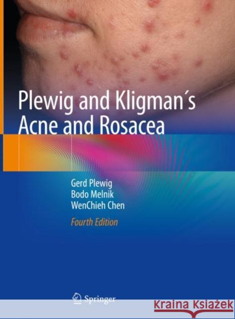 Plewig and Kligman´s Acne and Rosacea