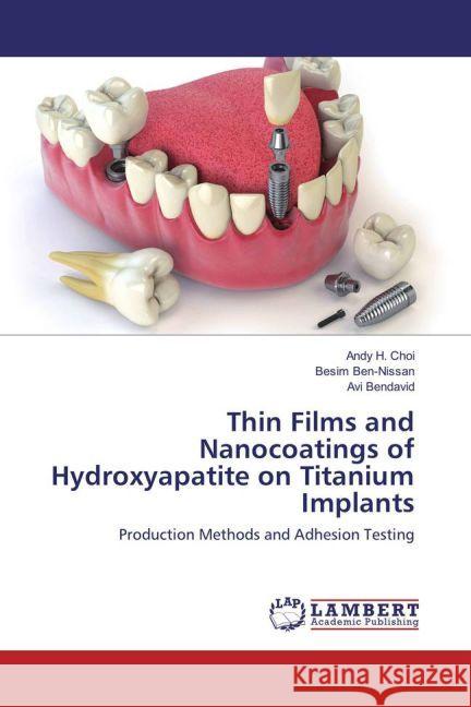 Thin Films and Nanocoatings of Hydroxyapatite on Titanium Implants : Production Methods and Adhesion Testing