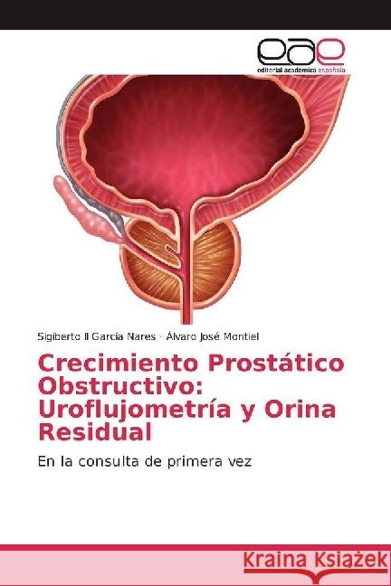 Crecimiento Prostático Obstructivo: Uroflujometría y Orina Residual : En la consulta de primera vez