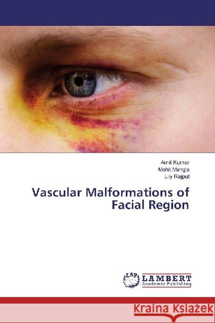 Vascular Malformations of Facial Region