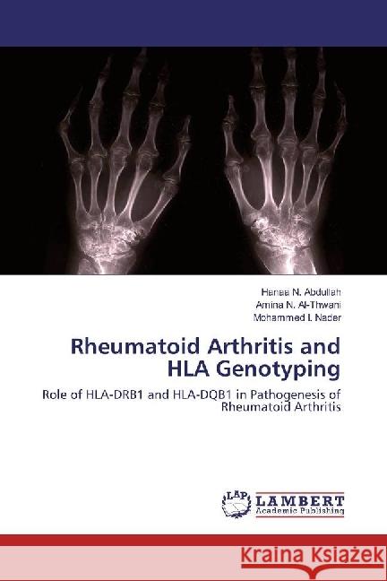 Rheumatoid Arthritis and HLA Genotyping : Role of HLA-DRB1 and HLA-DQB1 in Pathogenesis of Rheumatoid Arthritis
