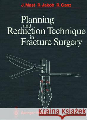 Planning and Reduction Technique in Fracture Surgery