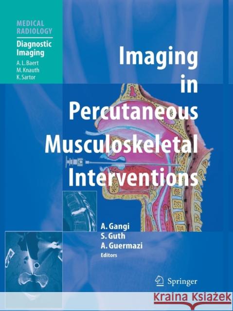 Imaging in Percutaneous Musculoskeletal Interventions