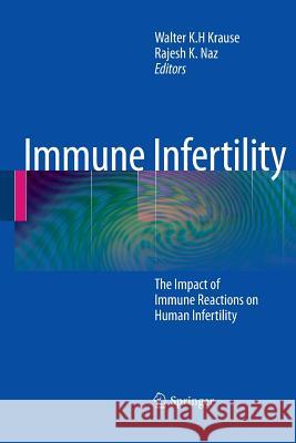 Immune Infertility: The Impact of Immune Reactions on Human Infertility