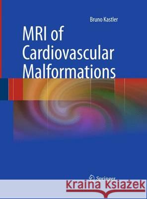 MRI of Cardiovascular Malformations