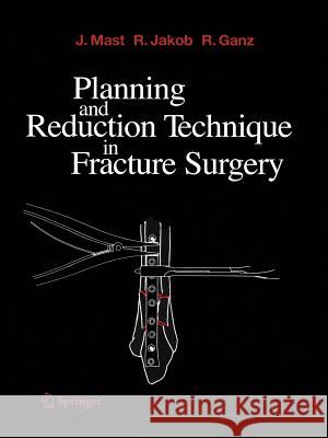 Planning and Reduction Technique in Fracture Surgery