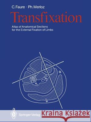 Transfixation: Atlas of Anatomical Sections for the External Fixation of Limbs