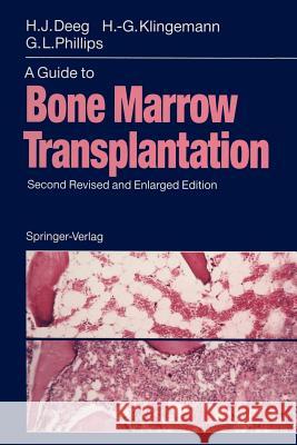 A Guide to Bone Marrow Transplantation