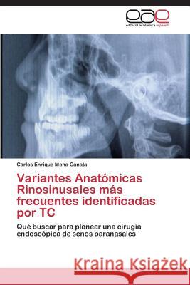 Variantes Anatómicas Rinosinusales más frecuentes identificadas por TC