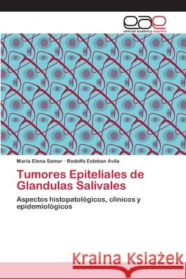 Tumores Epiteliales de Glandulas Salivales